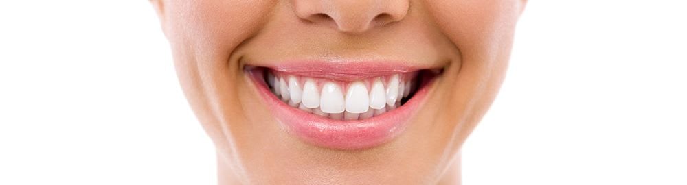 Implants and veneers top list of nation's oral health questions