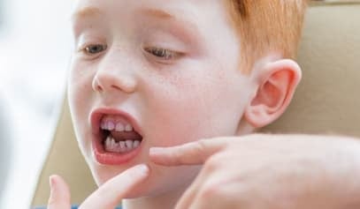 Dental packs for children