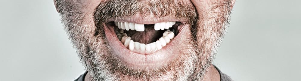 What to do following an extraction