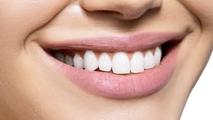 About tooth whitening