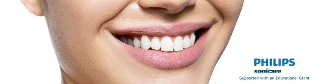 About tooth whitening