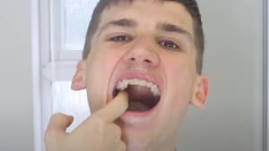 How to spot mouth cancer