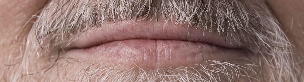 World Cancer Day: spot the signs of mouth cancer and act early