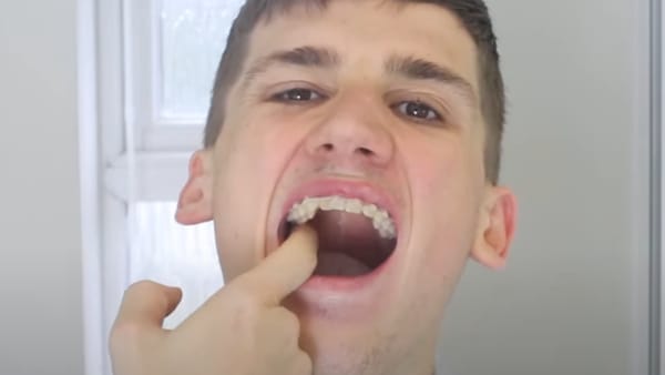 How to spot mouth cancer