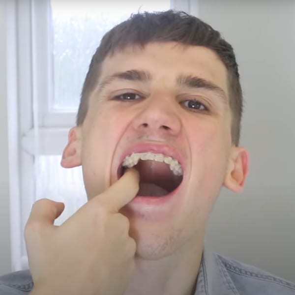 How to spot mouth cancer