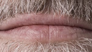 World Cancer Day: spot the signs of mouth cancer and act early