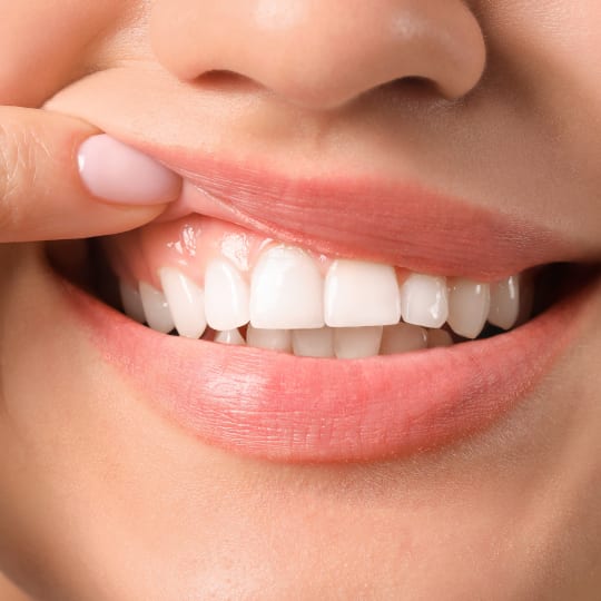 Woman with healthy gums
